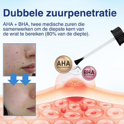 🌟 Officiële winkel | RZXEA™ AHA Wrattenverwijderingsvloeistof