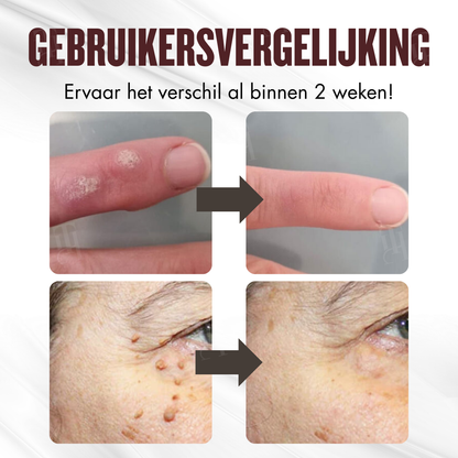 🌟 Officiële winkel | RZXEA™ All-in-1 Ceramide Huidcrème