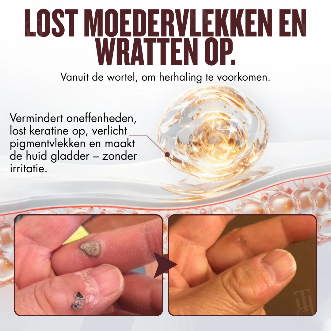 🌟 Officiële winkel | RZXEA™ All-in-1 Ceramide Huidcrème